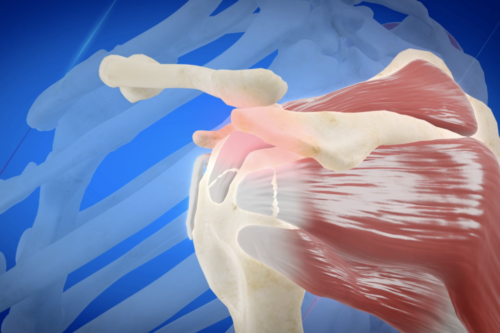 Il dolore alla spalla