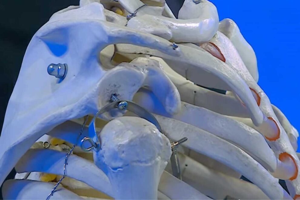 artrosi-alla-spalla_1 artrosi-alla-spalla_1