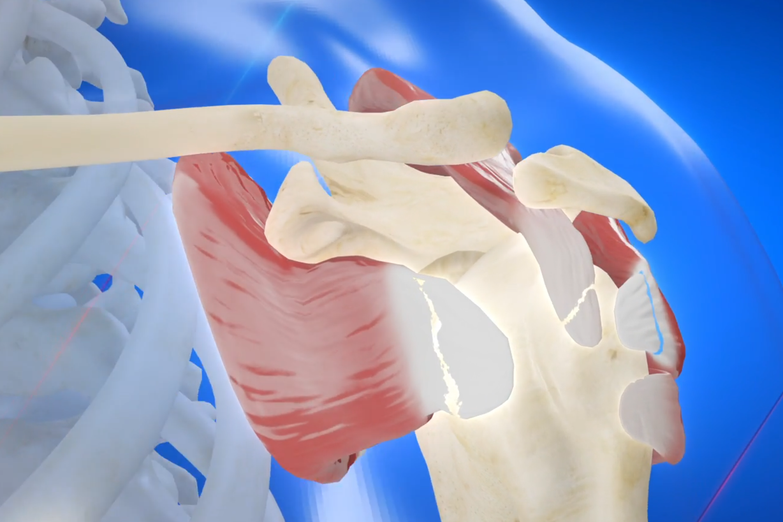 le lesioni dei tendini della cuffia dei rotatori