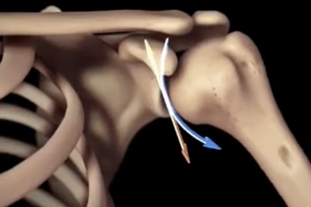 Instabilità di spalla