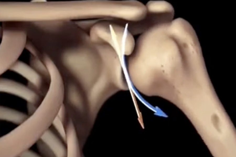 Instabilità di spalla lussazione