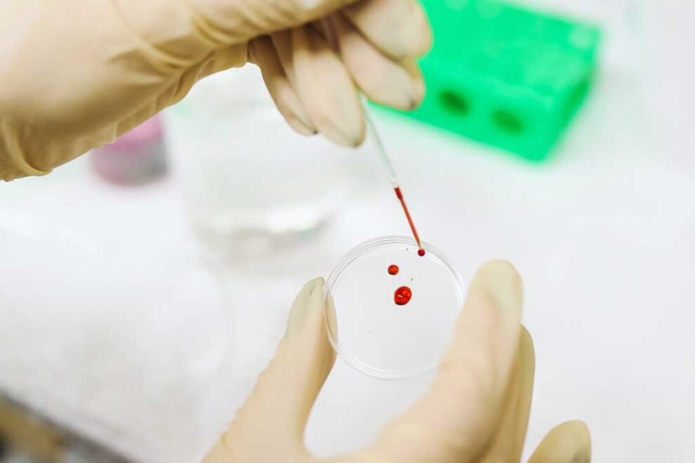 le-infiltrazioni-con-i-fattori-di-crescita