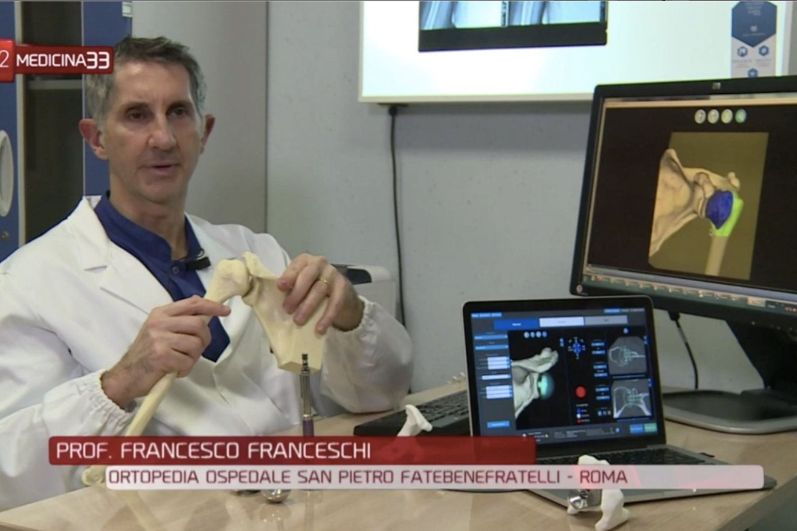 le protesi di spalla