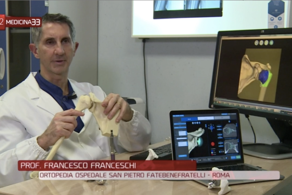 le protesi di spalla