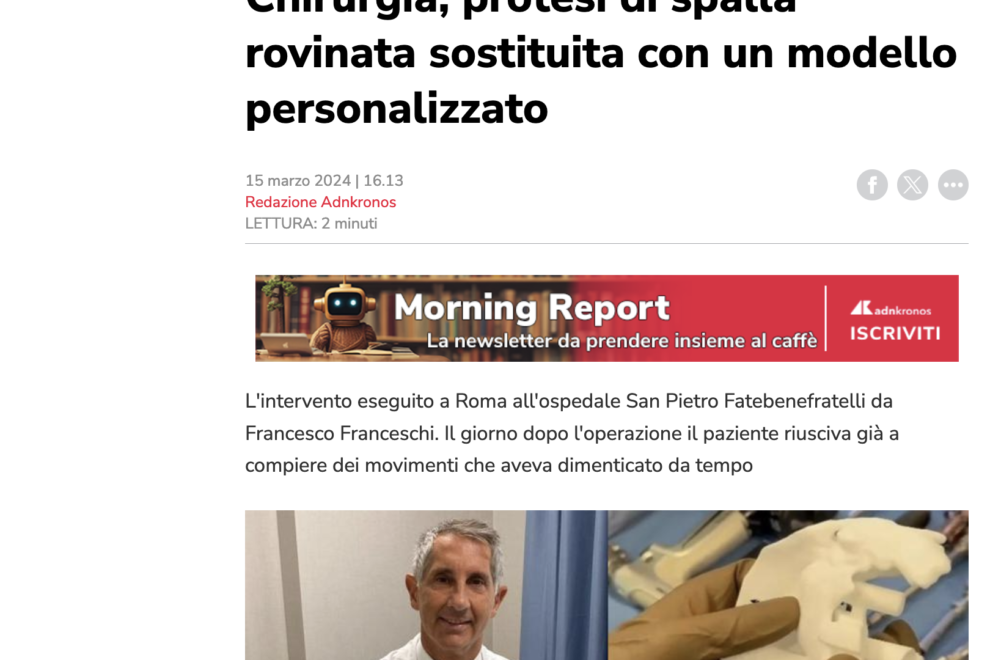 Protesi di spalla personalizzata ADN-Kronos Protesi di spalla personalizzata ADN-Kronos