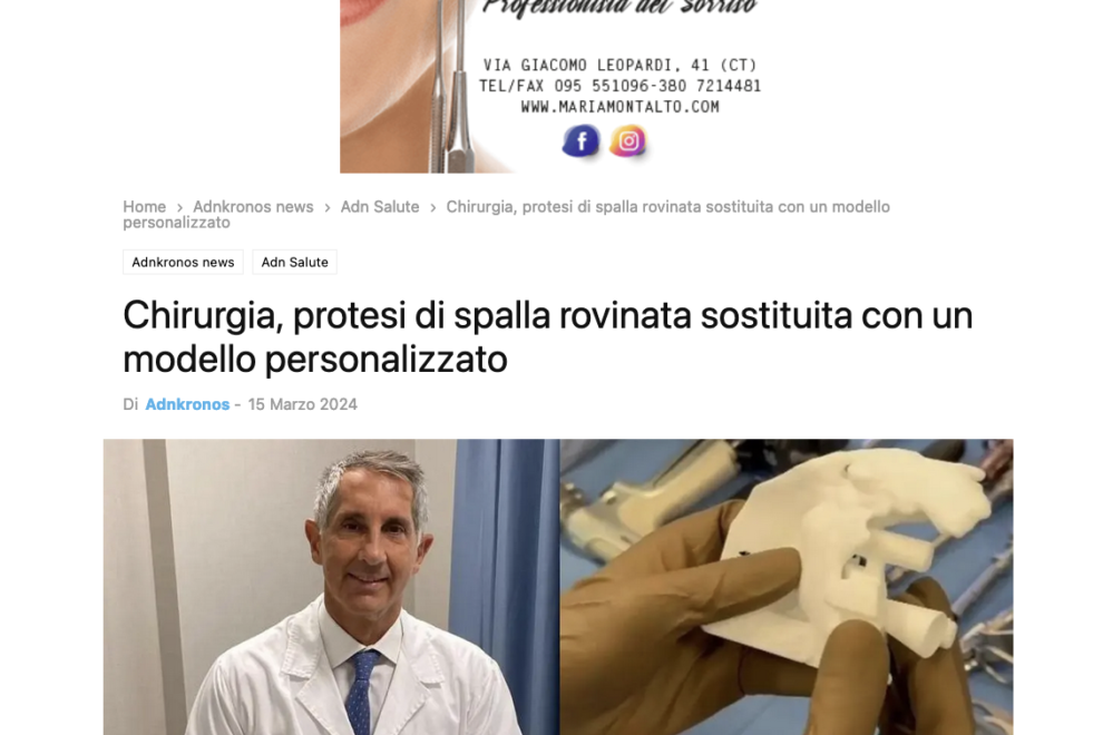Protesi di spalla personalizzata Sicilia-Report Protesi di spalla personalizzata Sicilia-Report
